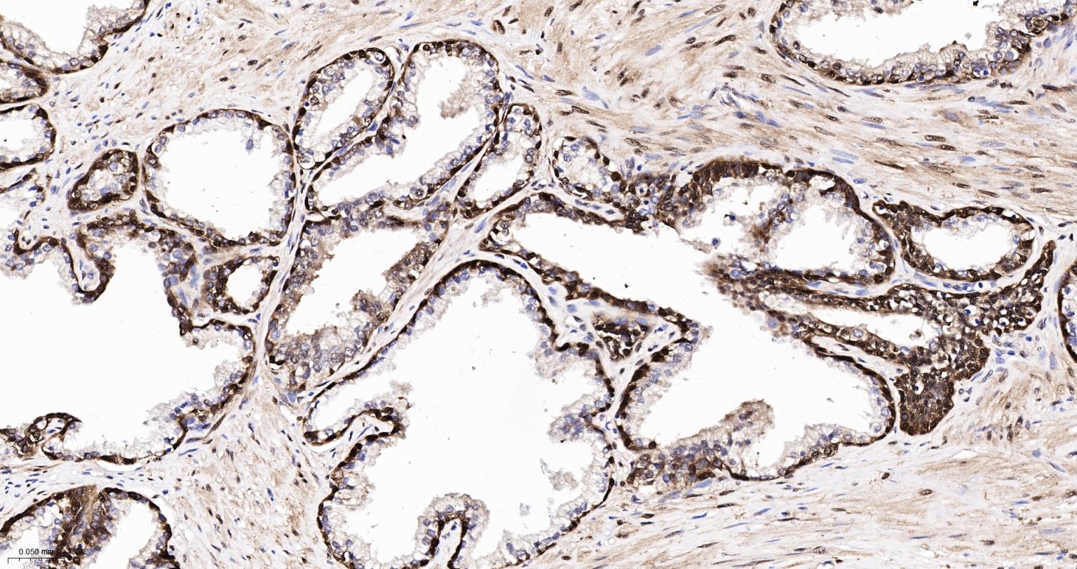 热休克蛋白-70重组兔单抗
