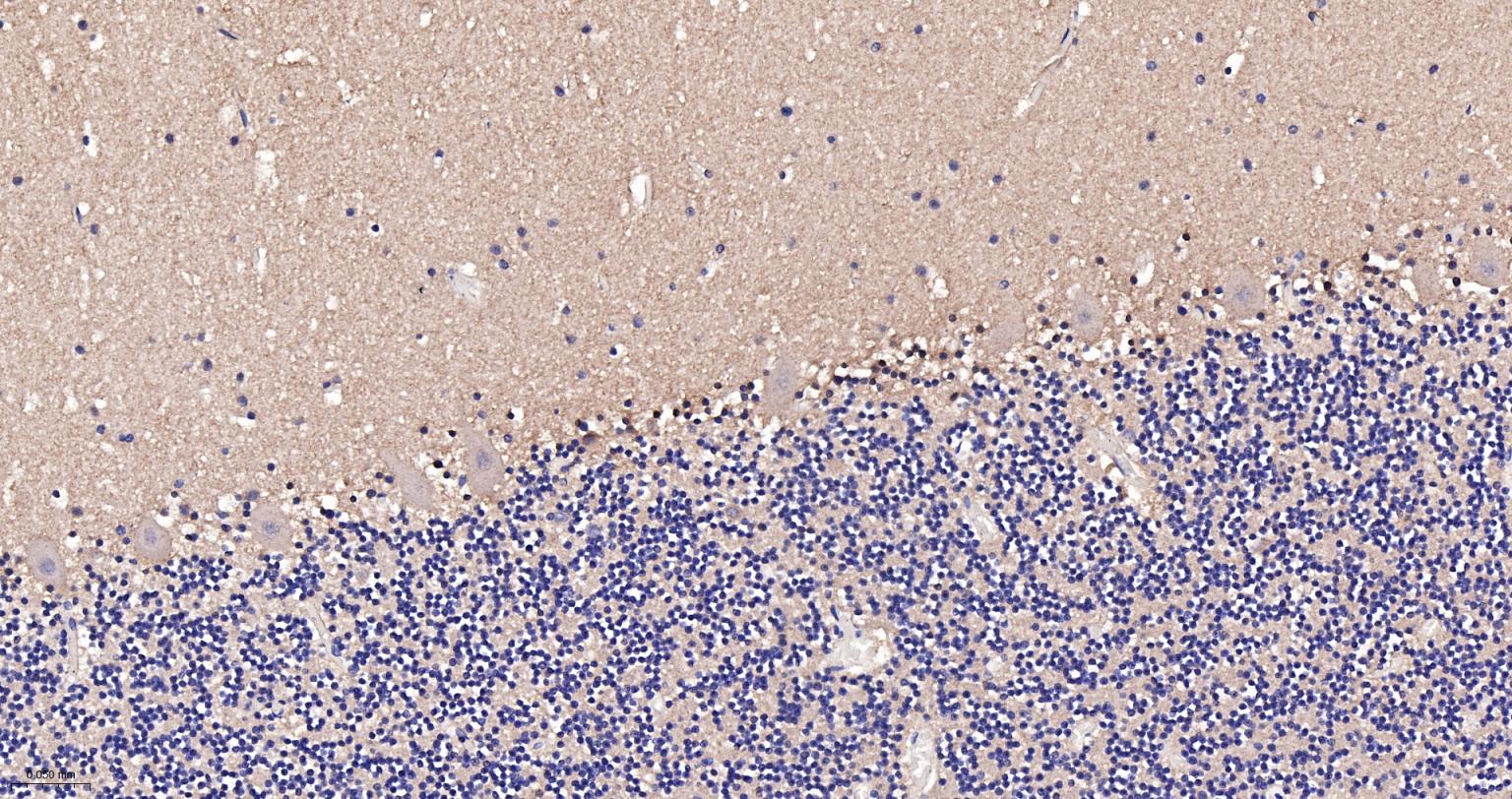 老年痴呆相关类钙粘蛋白CS1重组兔单抗