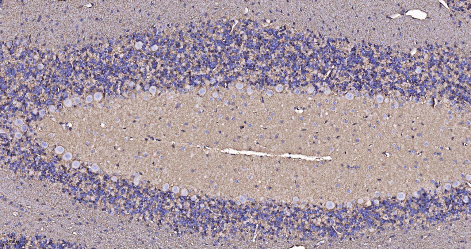 水通道蛋白4重组兔单抗