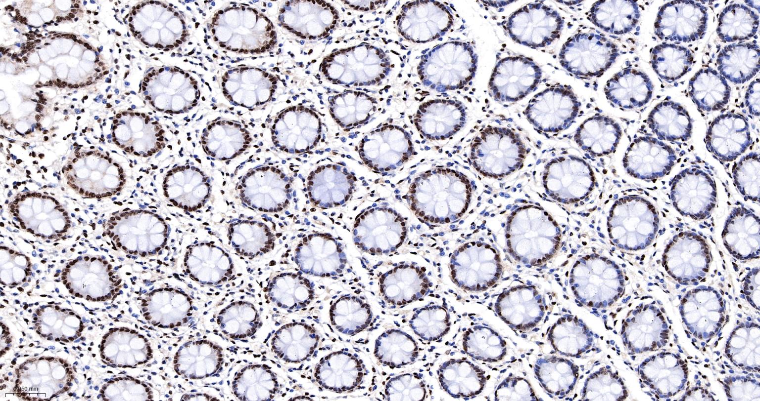 异型组蛋白H2A.1重组兔单抗-bsm-61665R