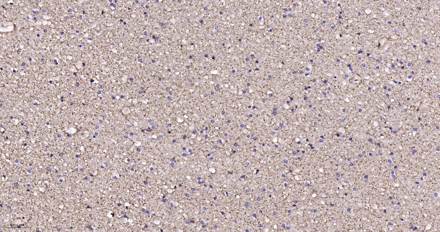 水通道蛋白4重组兔单抗