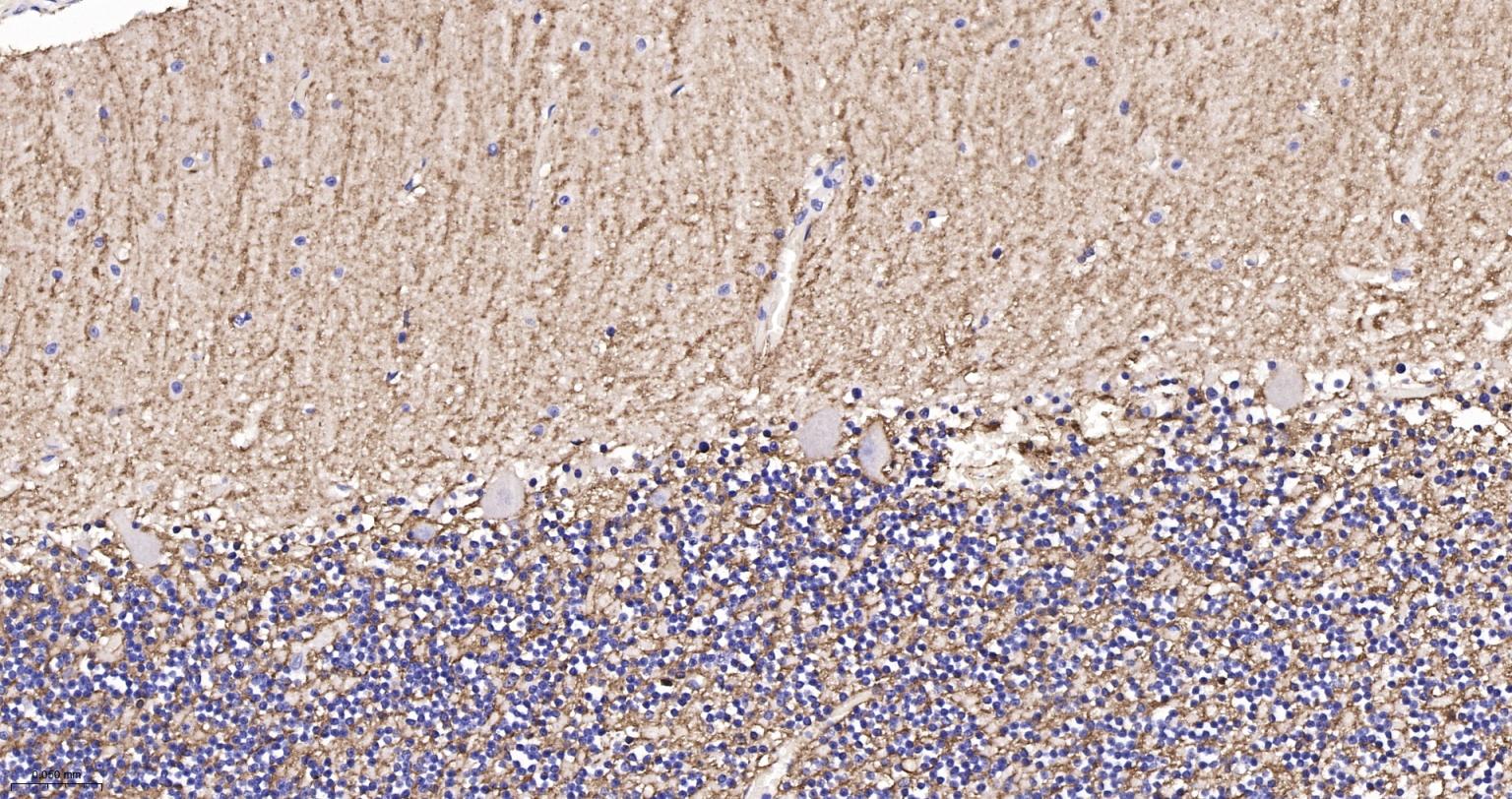 水通道蛋白4重组兔单抗