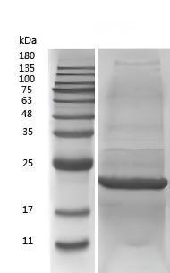 重组人结缔组织生长因子-bs-48115P