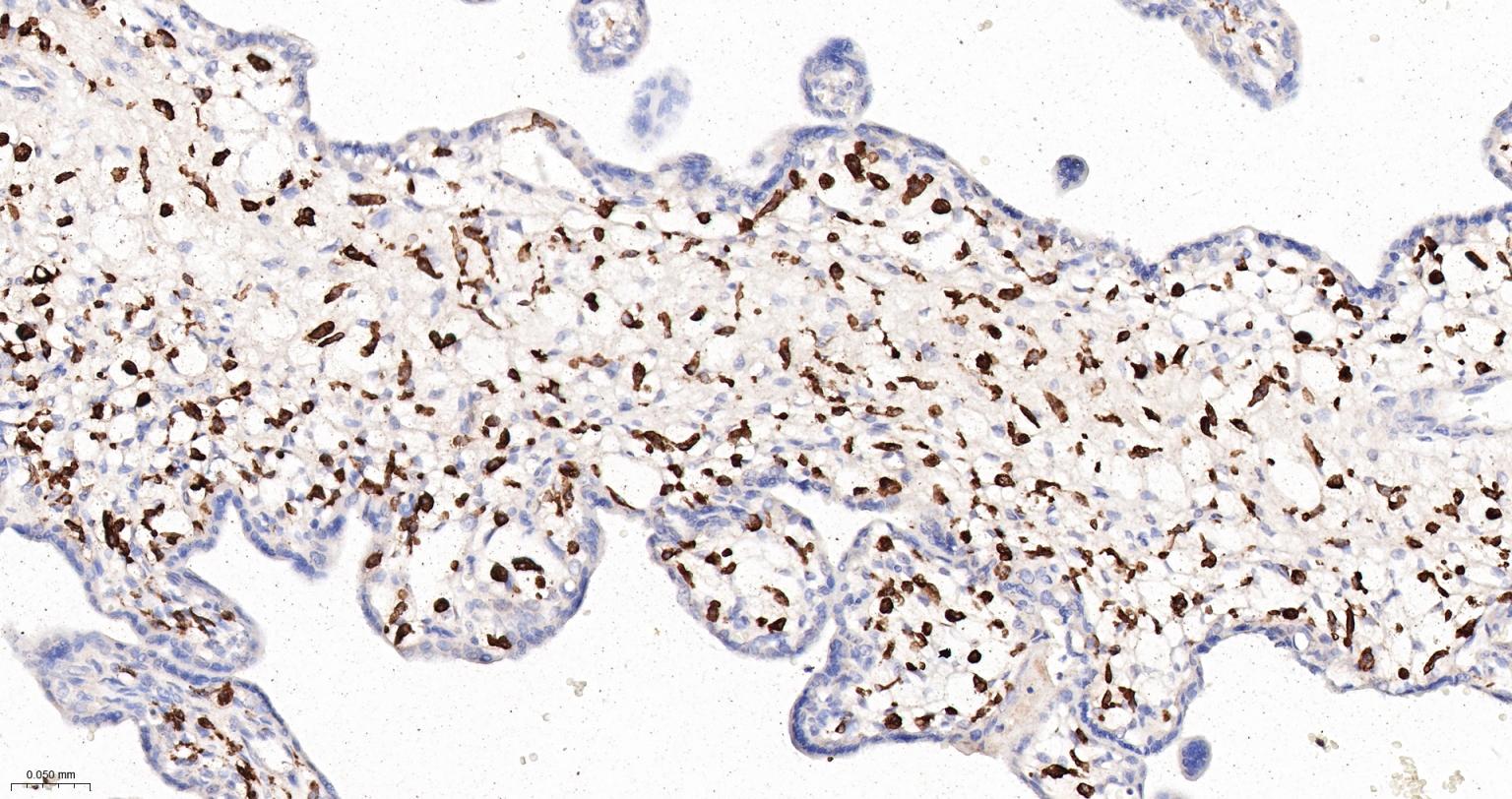 CD163重组兔单抗