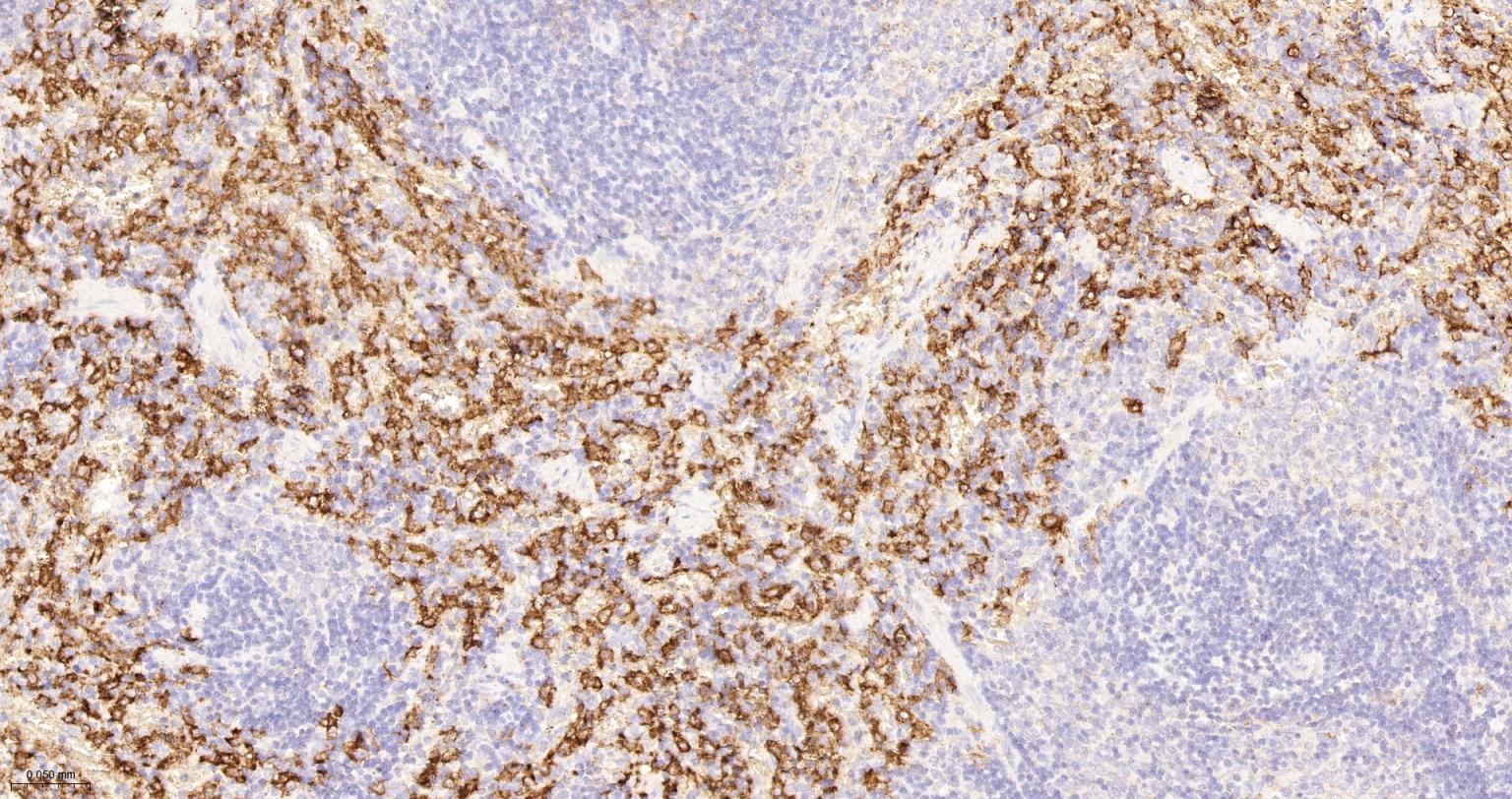 CD163重组兔单抗