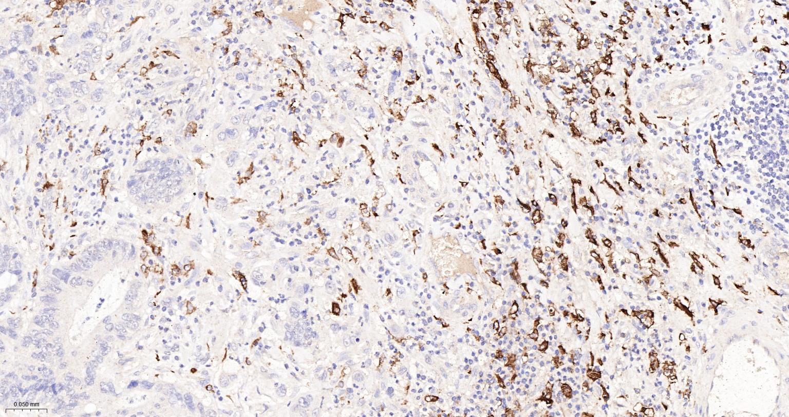 CD163重组兔单抗