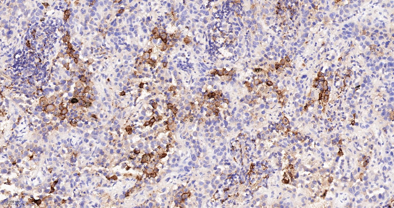 CD163重组兔单抗