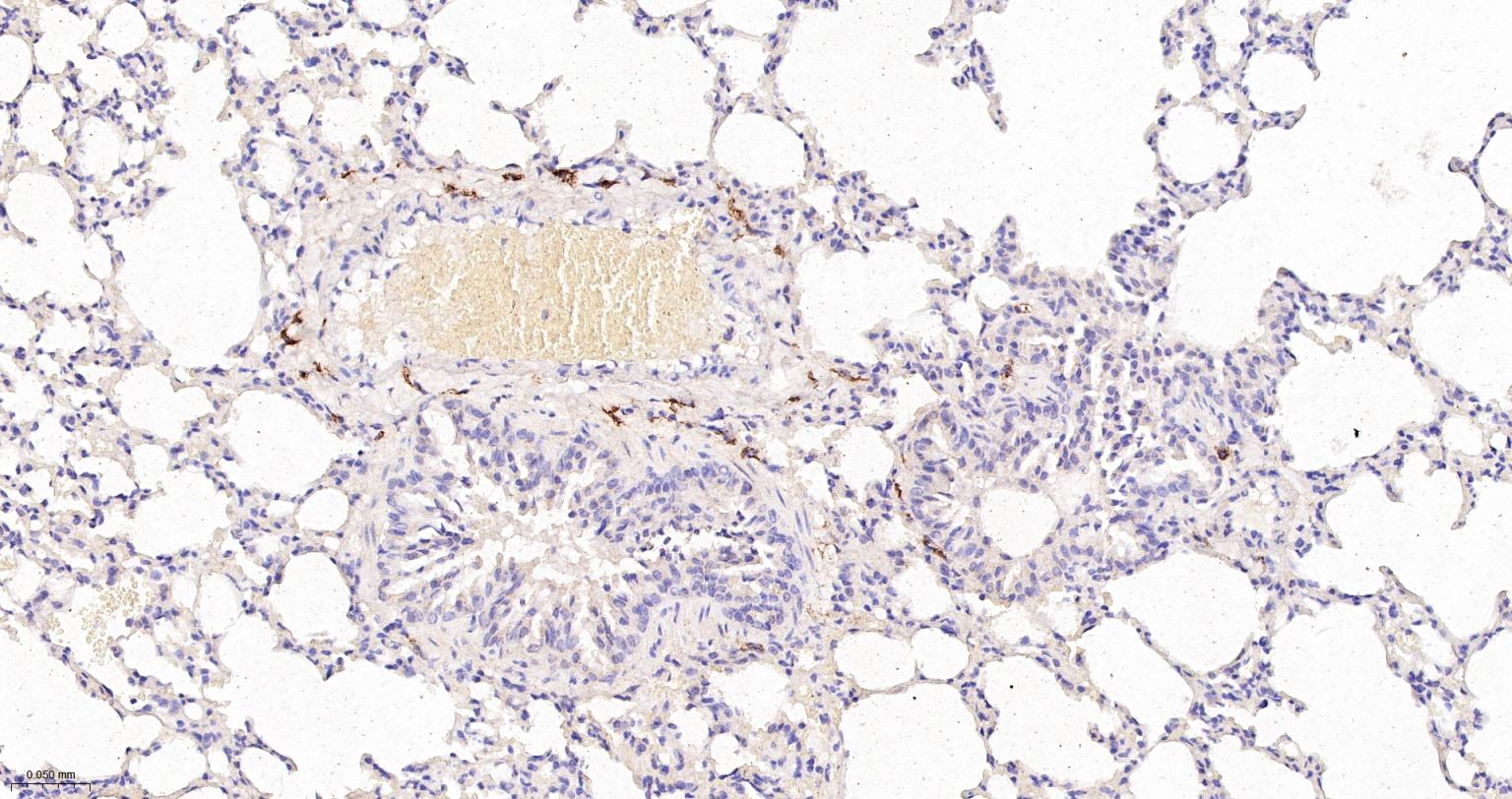 CD163重组兔单抗