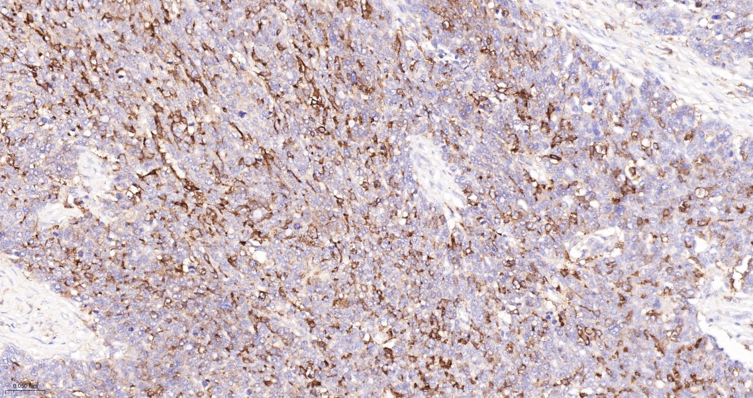 CD163重组兔单抗