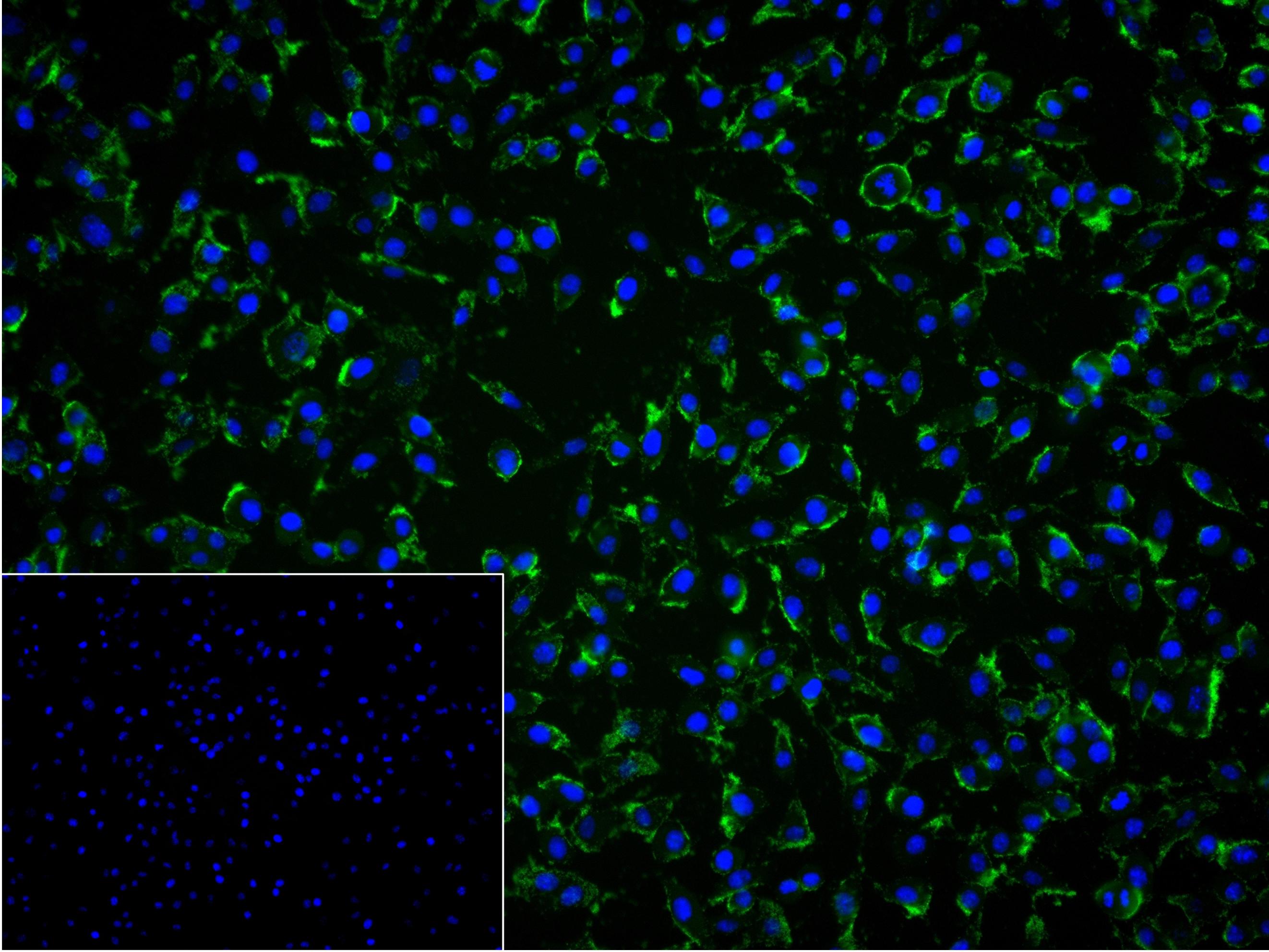 NCAM Recombinant Rabbit mAb (一抗) - ICC/IF | Bioss