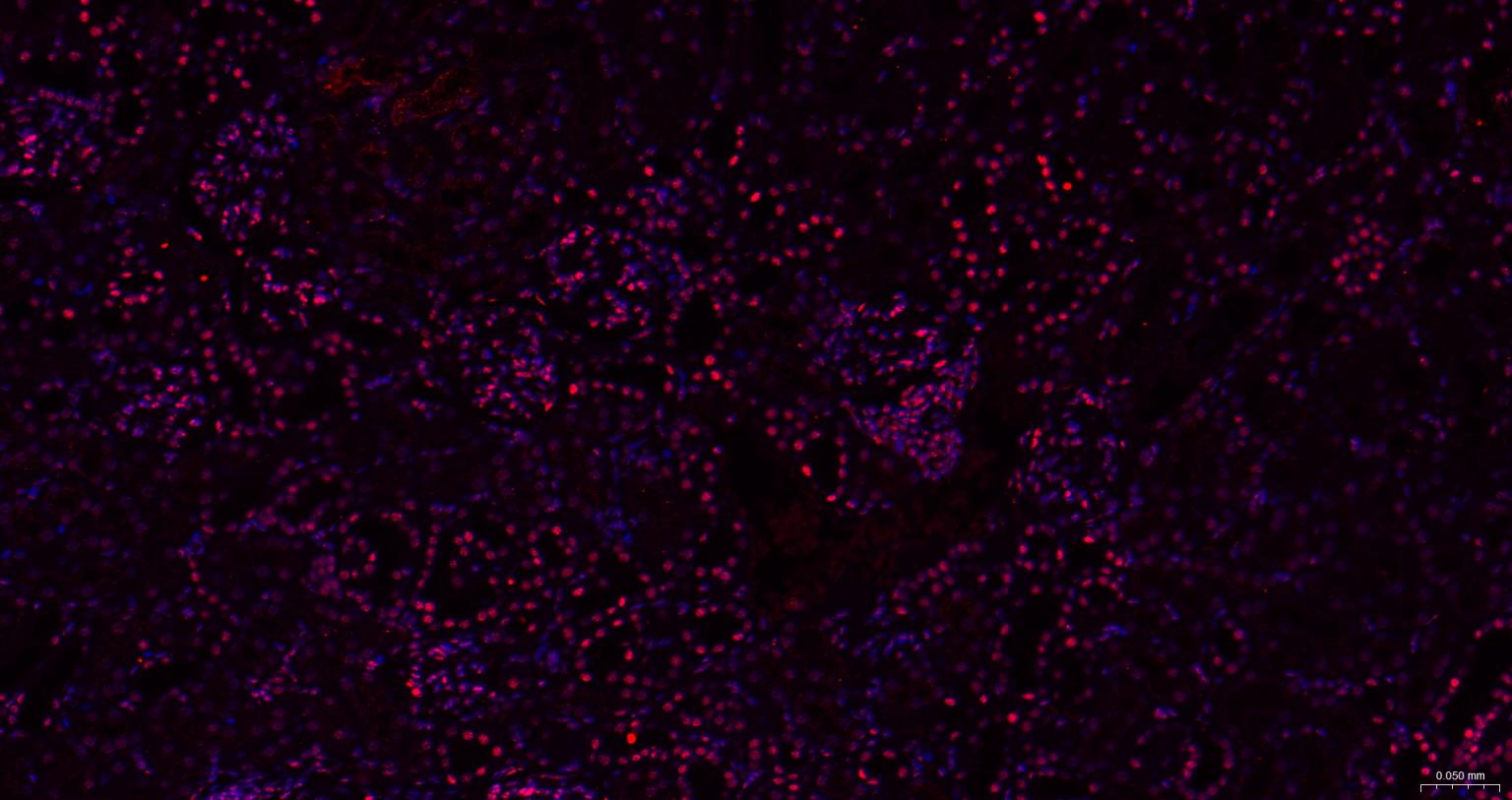 抑癌基因SNF2β重组兔单抗