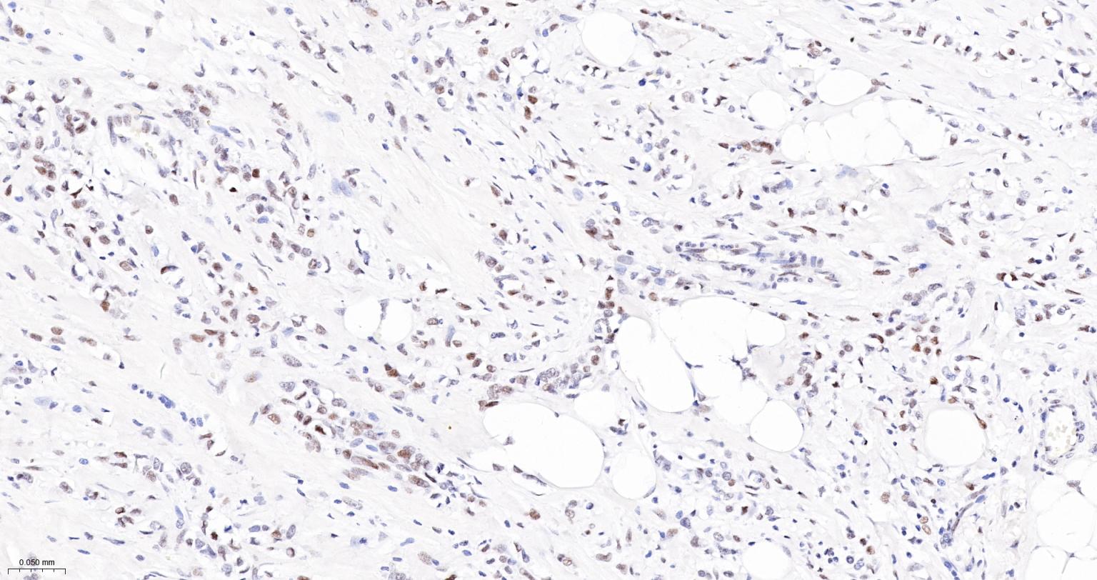 染色体结构维持蛋白质1α重组兔单抗