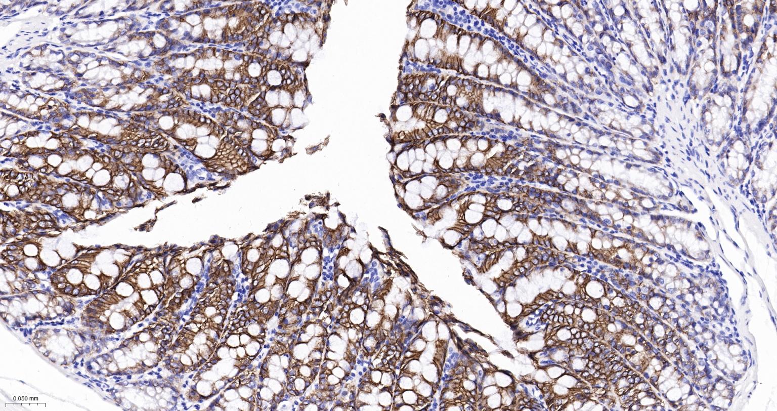 水通道蛋白4重组兔单抗