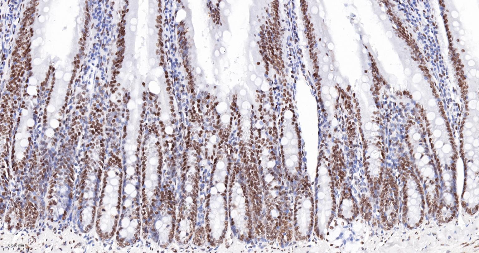 染色体结构维持蛋白质1α重组兔单抗