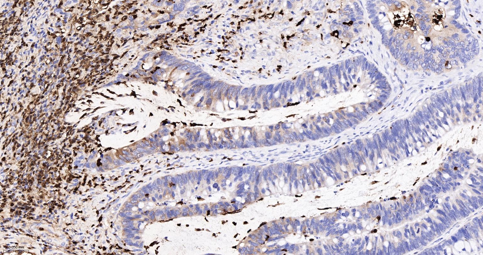 S100钙结合蛋白A8重组兔单抗