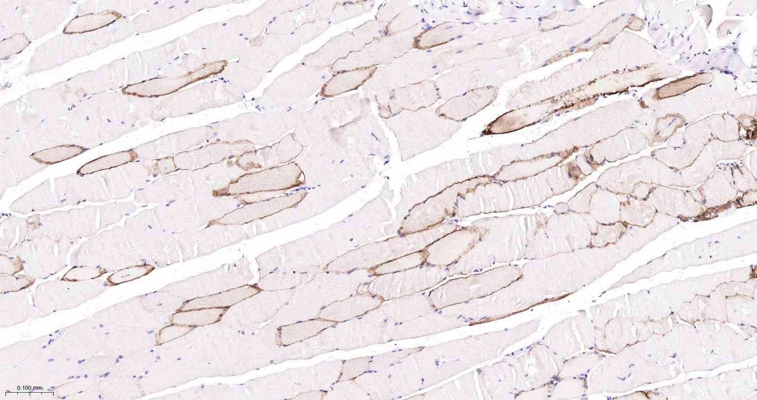 水通道蛋白4重组兔单抗