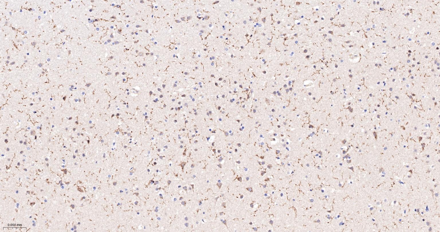 一种肿瘤抑制基因抗体