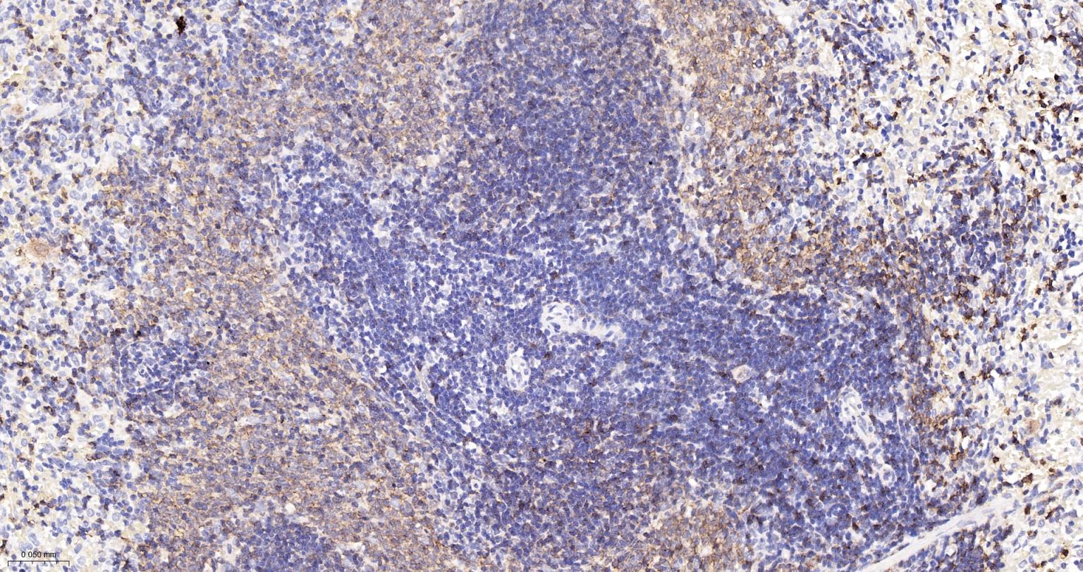 整合素α2（CD49b）重组兔单抗