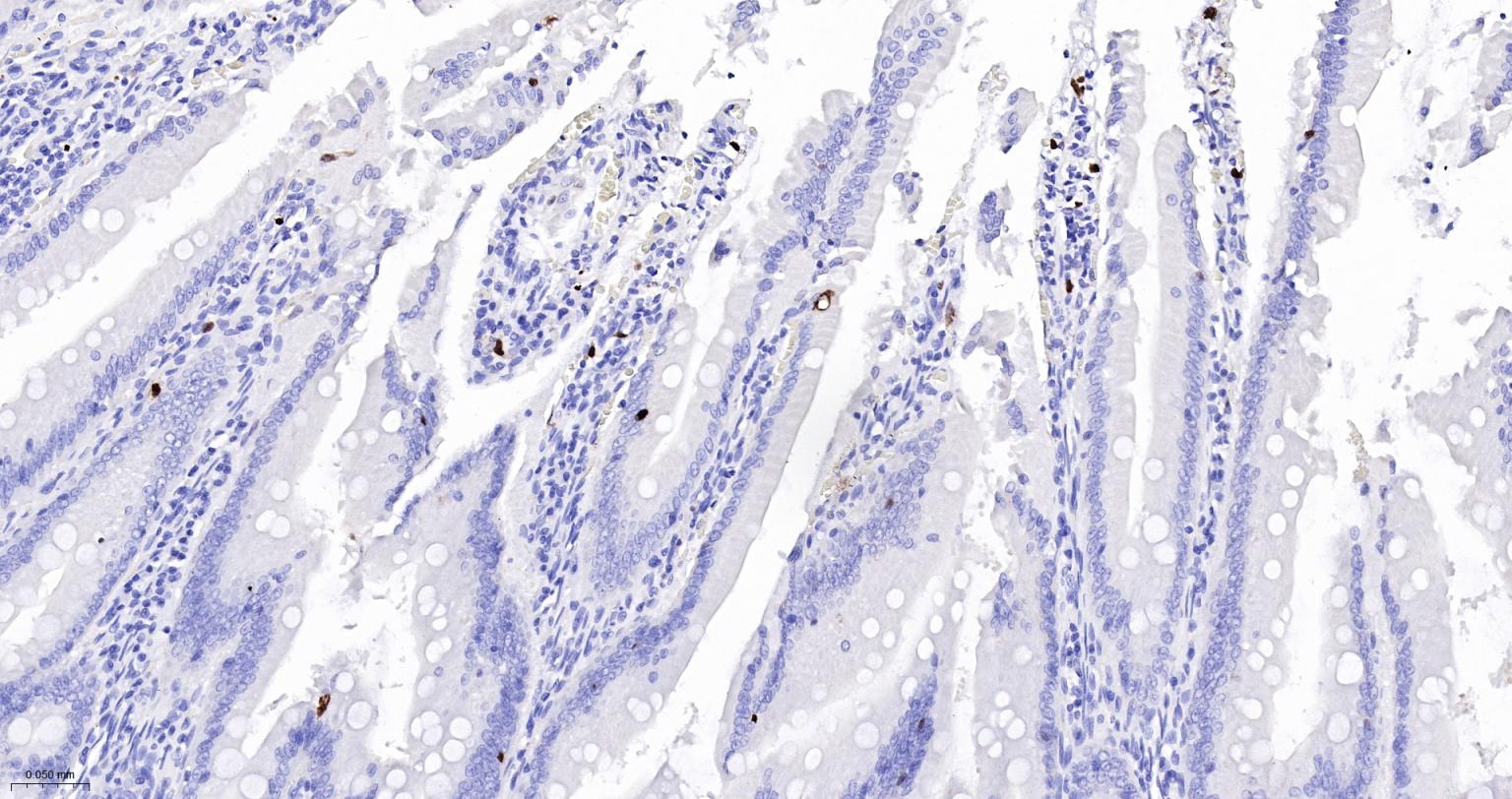 S100钙结合蛋白A8重组兔单抗