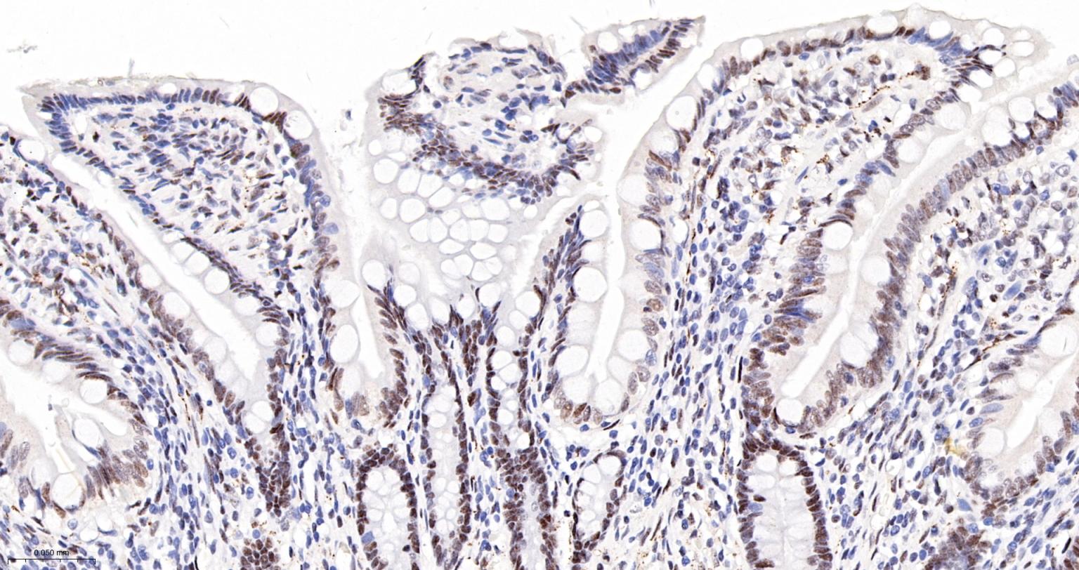 染色体结构维持蛋白质1α重组兔单抗