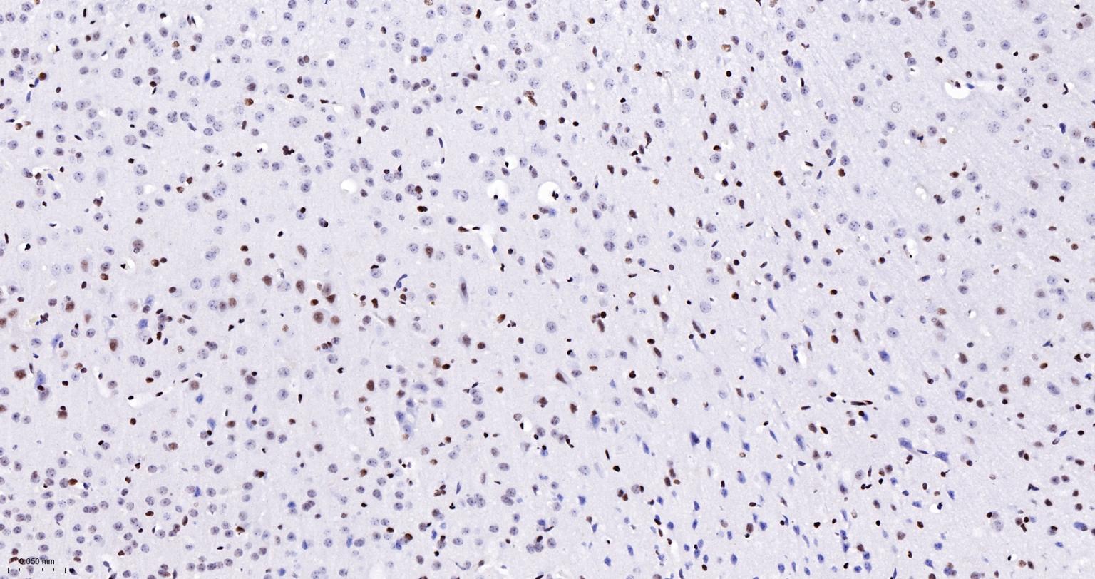 染色体结构维持蛋白质1α重组兔单抗