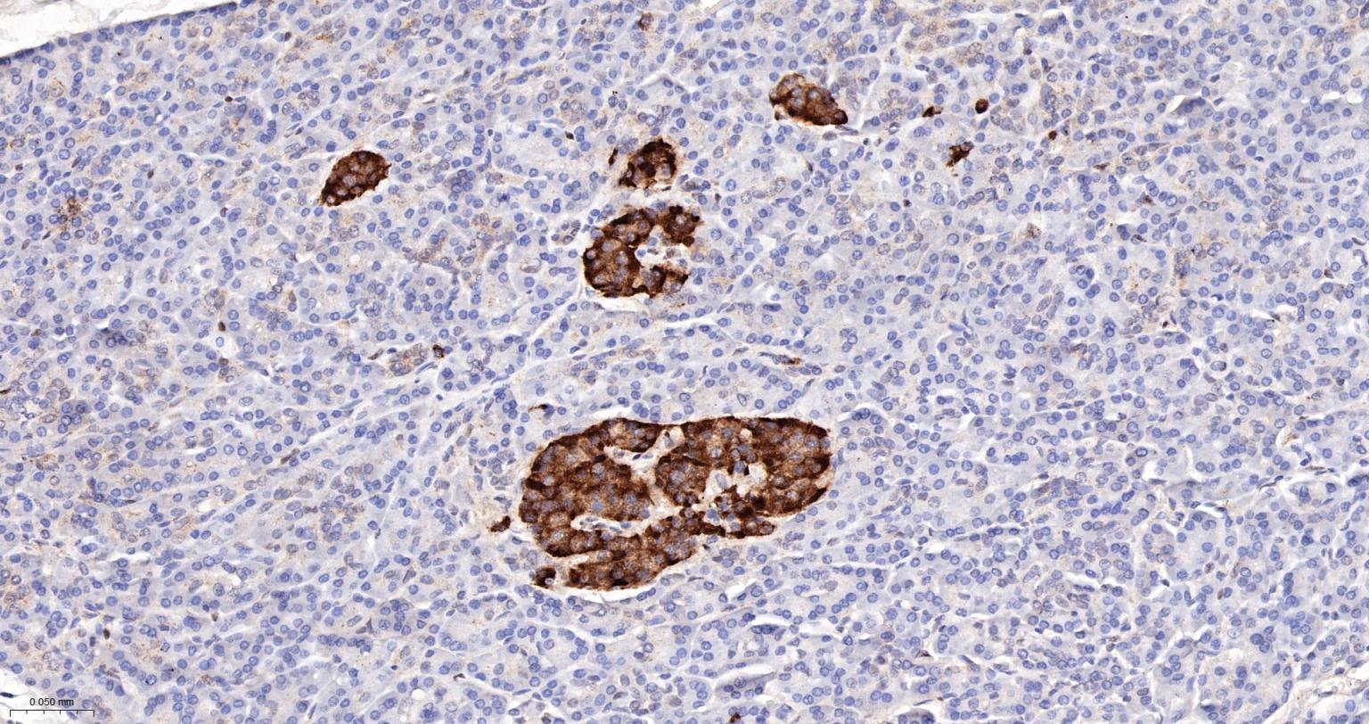 一种肿瘤抑制基因抗体