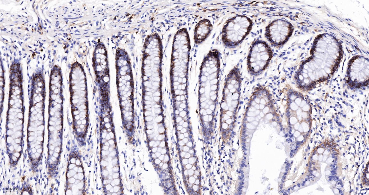 整合素α2（CD49b）重组兔单抗