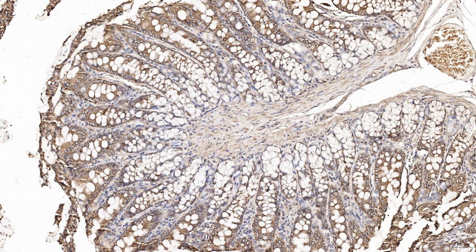 细胞角蛋白18抗体(C端)-bs-1339R