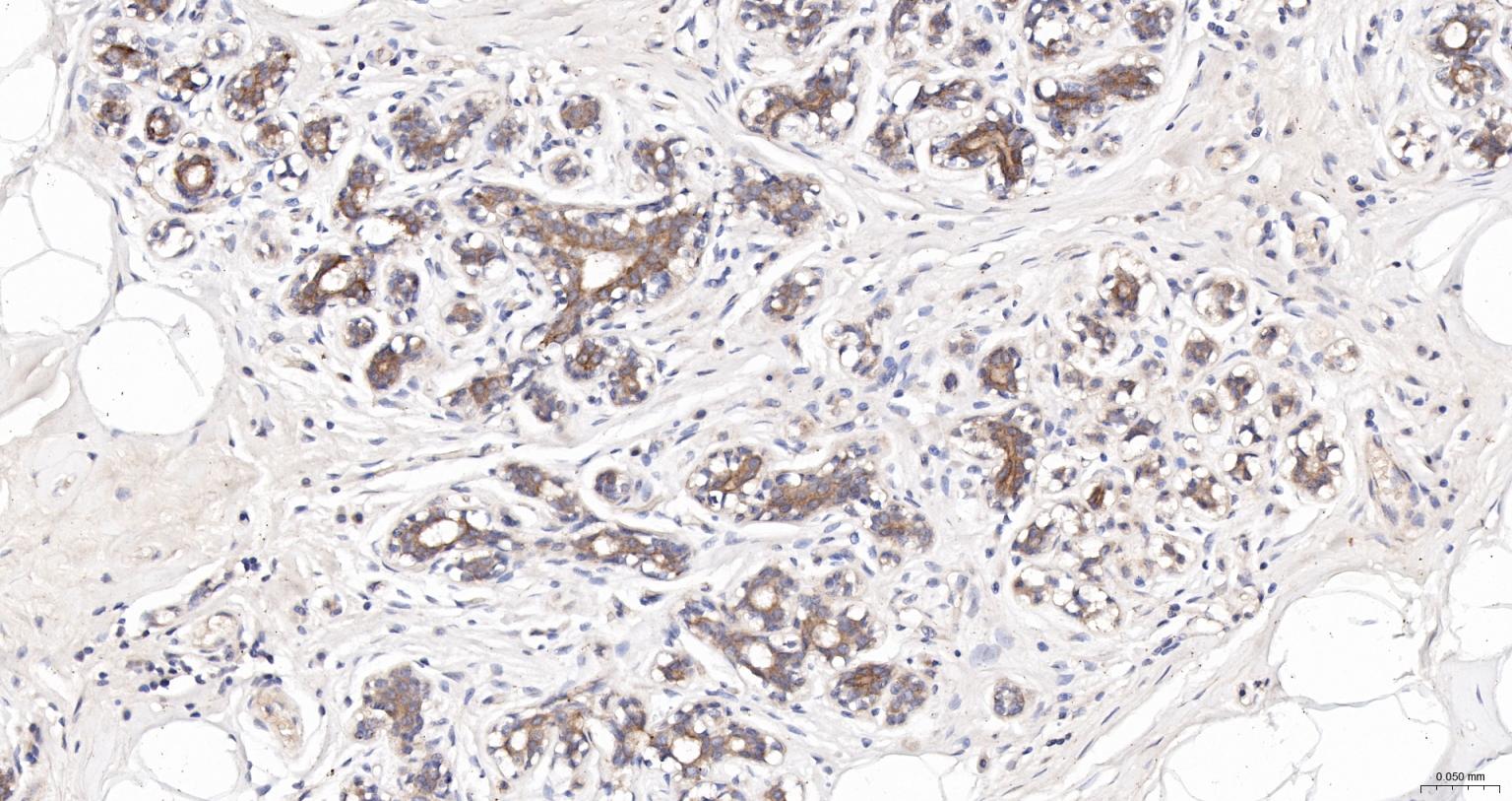 广谱细胞角蛋白PCK抗体