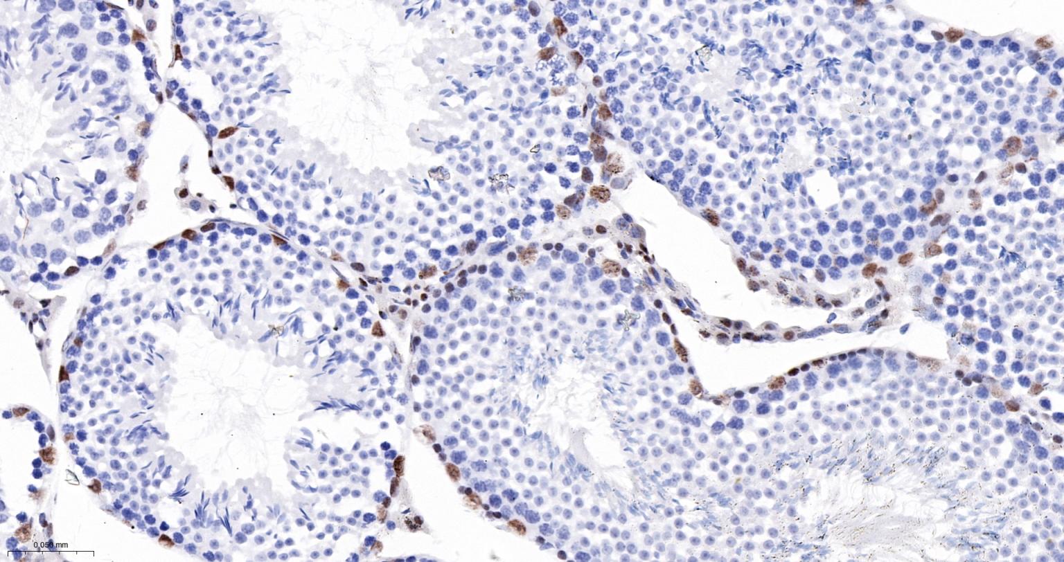 染色体结构维持蛋白质1α重组兔单抗
