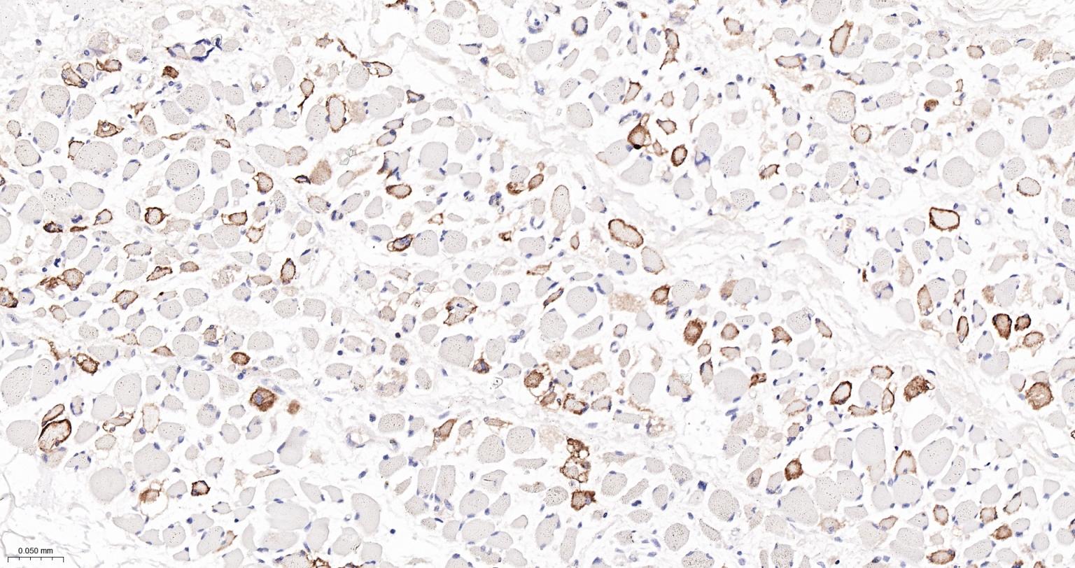 水通道蛋白4重组兔单抗