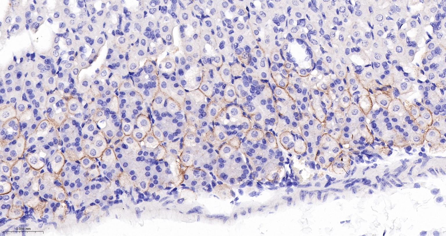 胞质紧密粘连蛋白1/闭锁小带蛋白1重组兔单抗