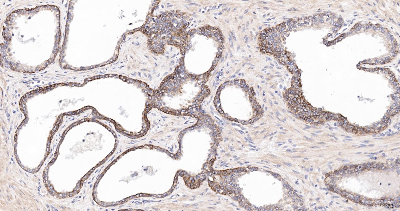 广谱细胞角蛋白PCK抗体