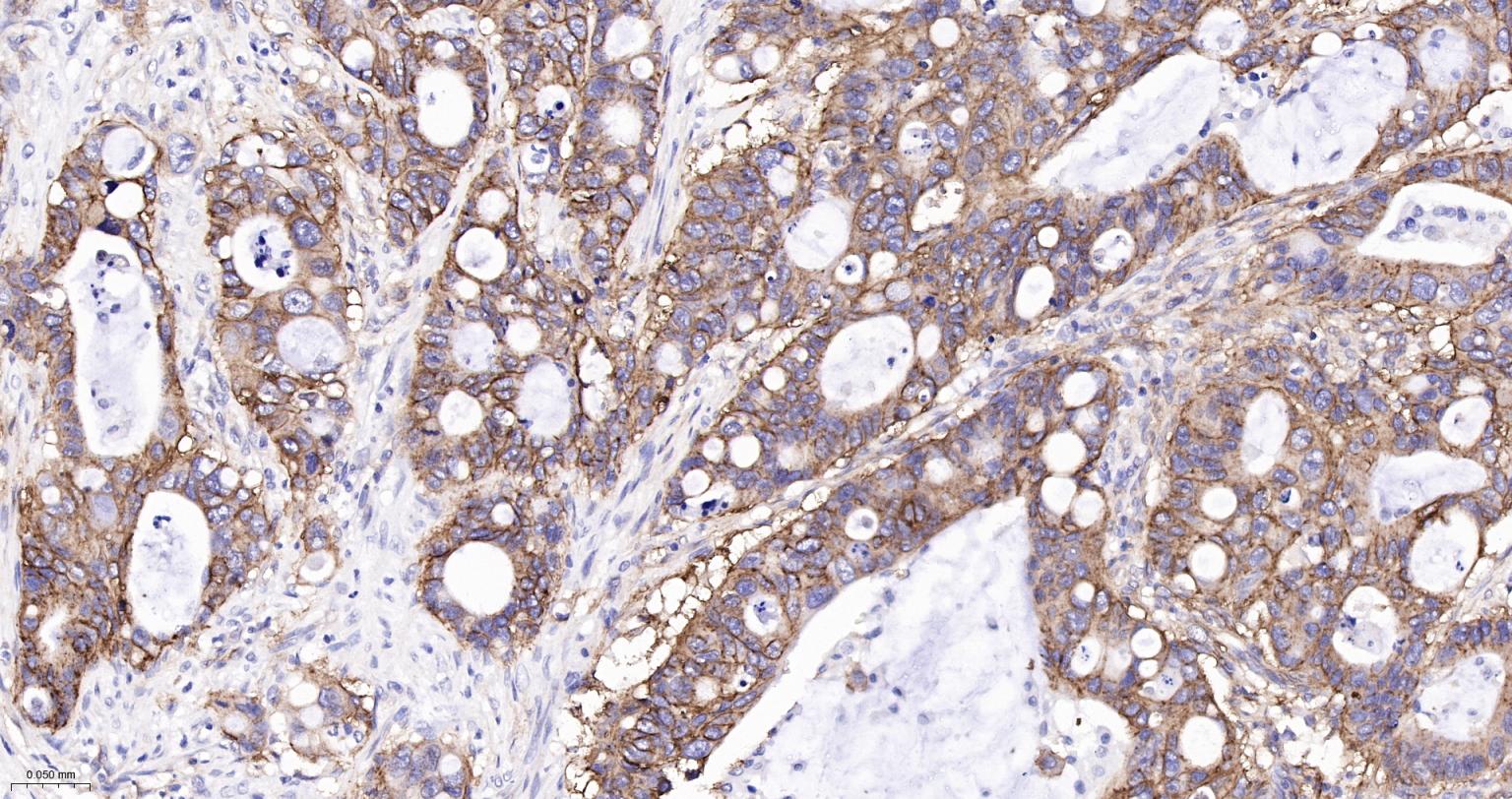 整合素α2（CD49b）重组兔单抗