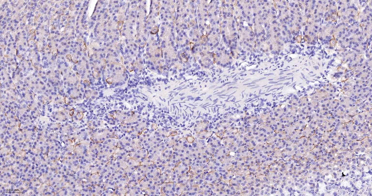 胞质紧密粘连蛋白1/闭锁小带蛋白1重组兔单抗
