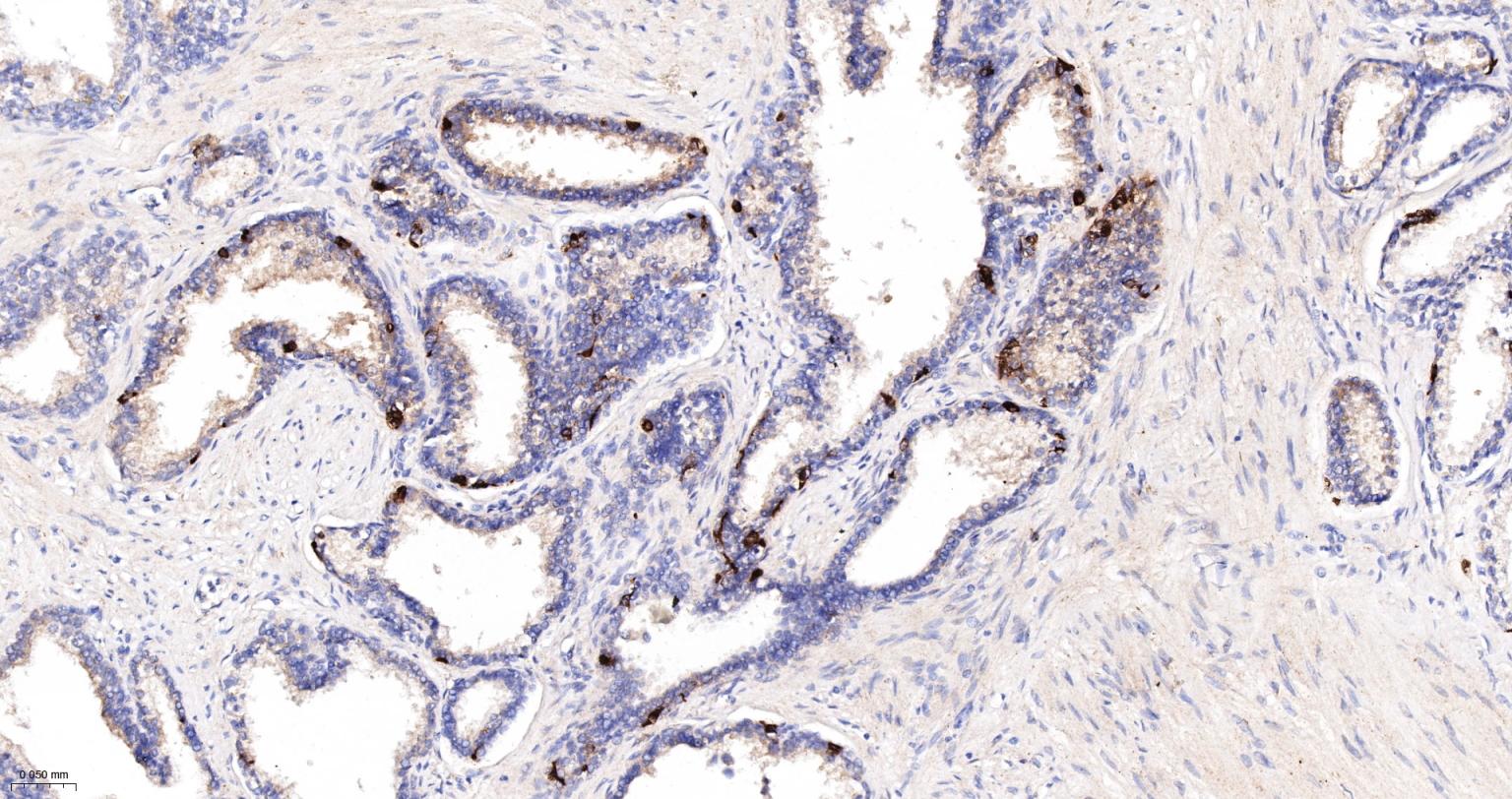 一种肿瘤抑制基因抗体