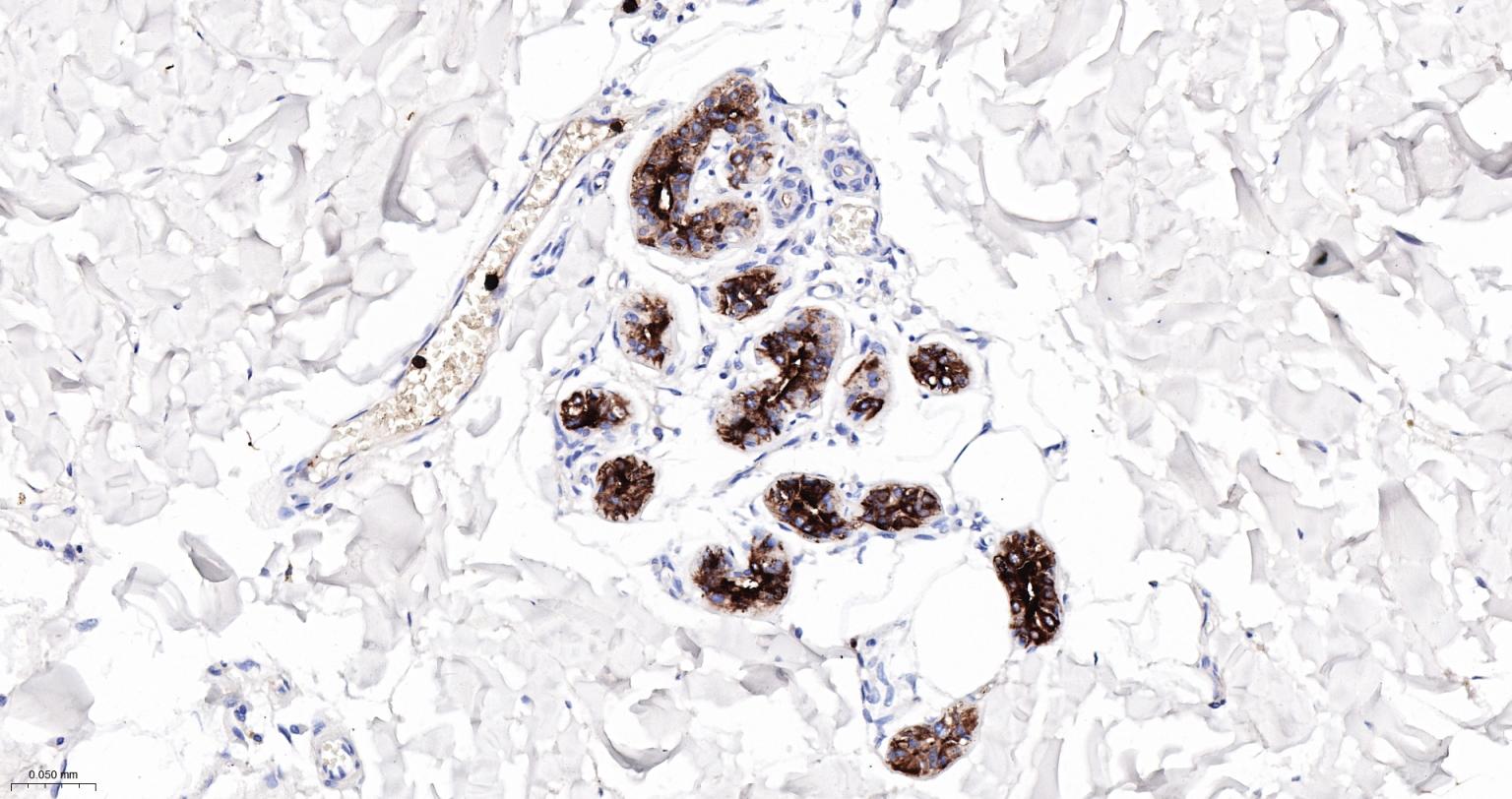 S100钙结合蛋白A8重组兔单抗
