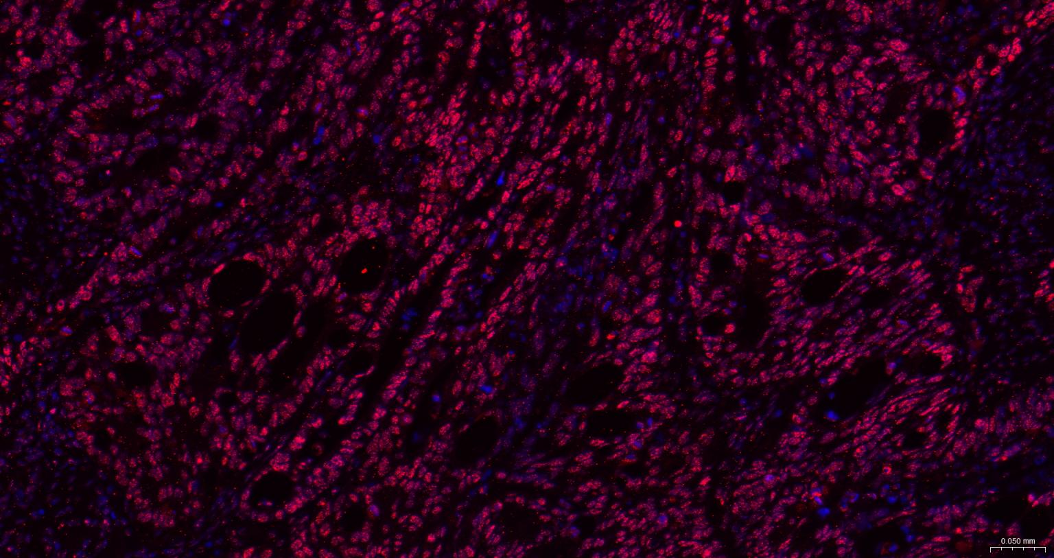 抑癌基因SNF2β重组兔单抗