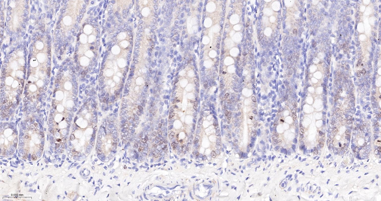 细胞凋亡抑制因子重组兔单抗