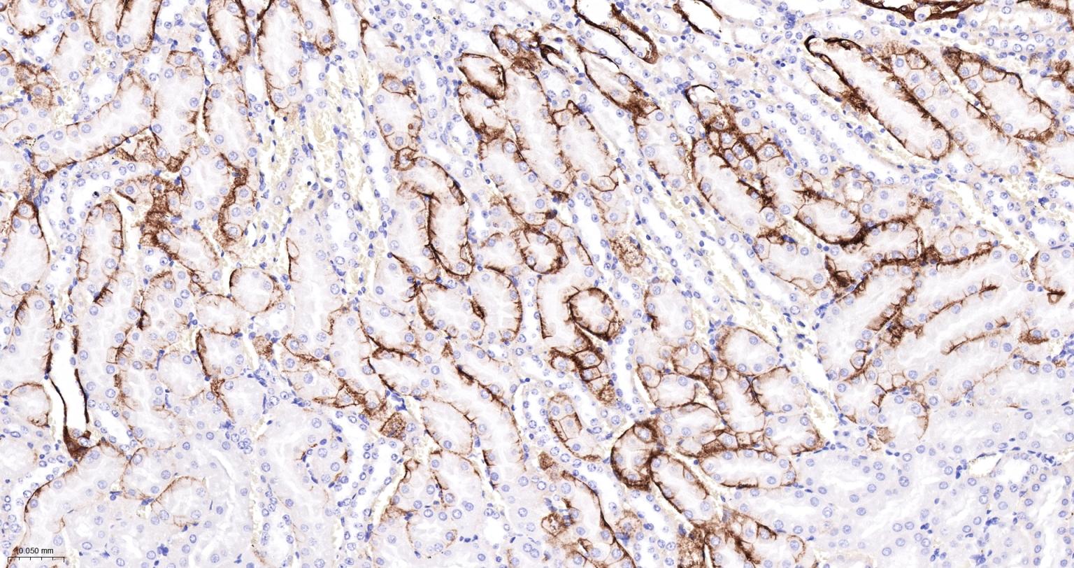 水通道蛋白4重组兔单抗