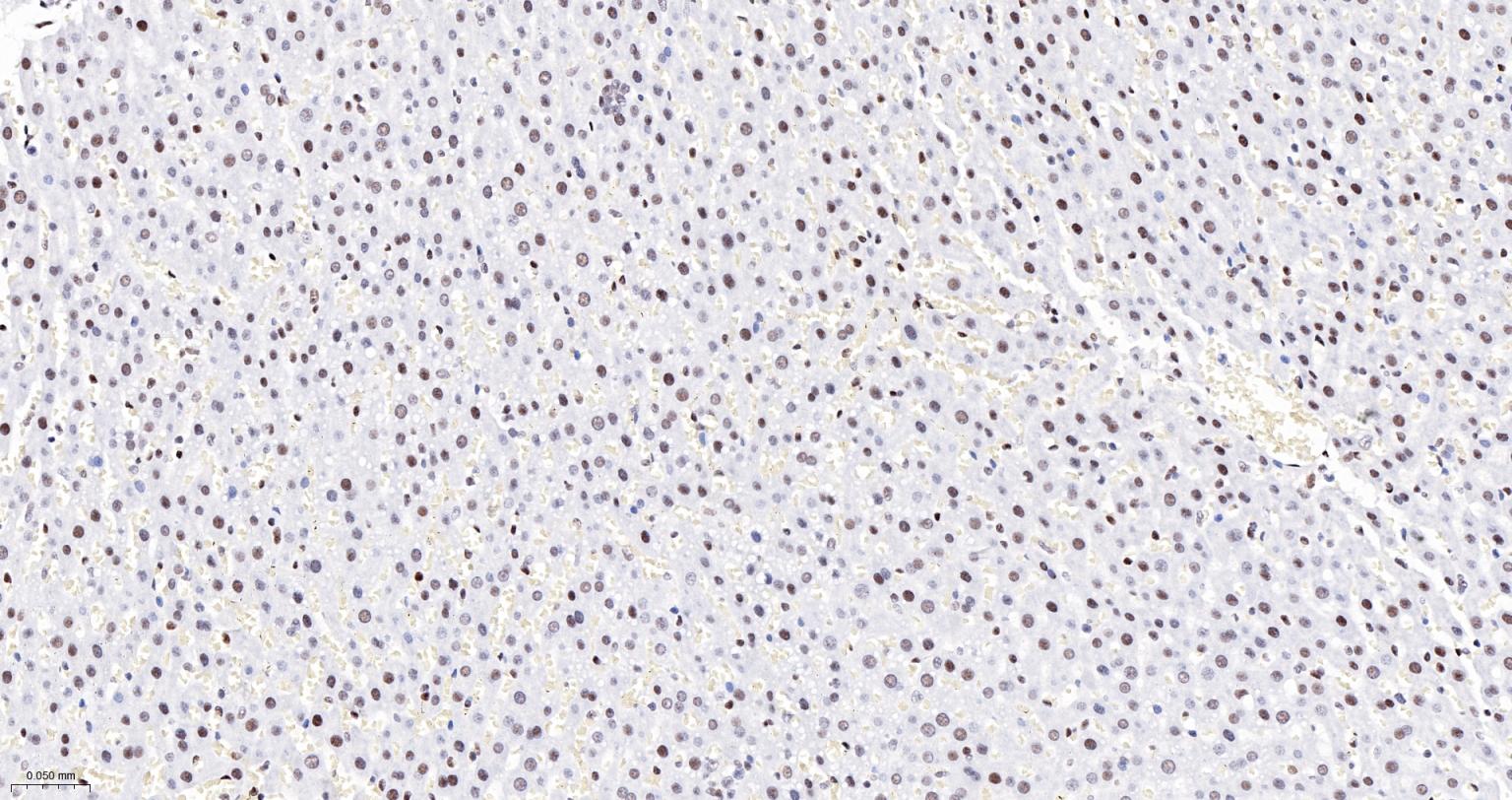 染色体结构维持蛋白质1α重组兔单抗