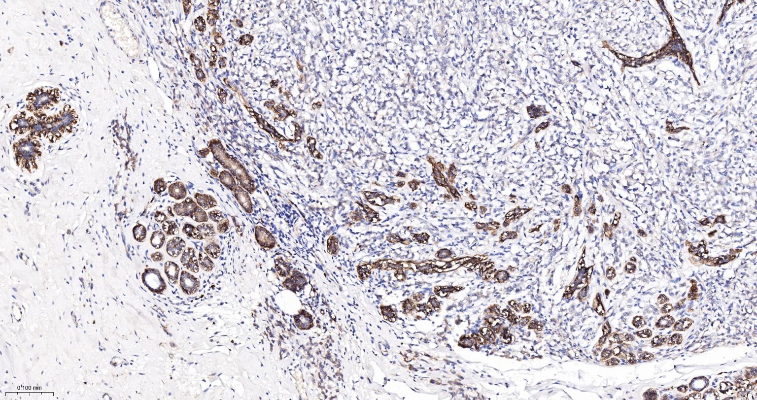 整合素α2（CD49b）重组兔单抗