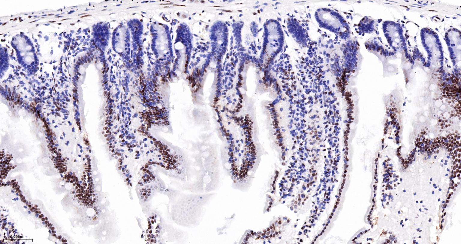 染色体结构维持蛋白质1α重组兔单抗