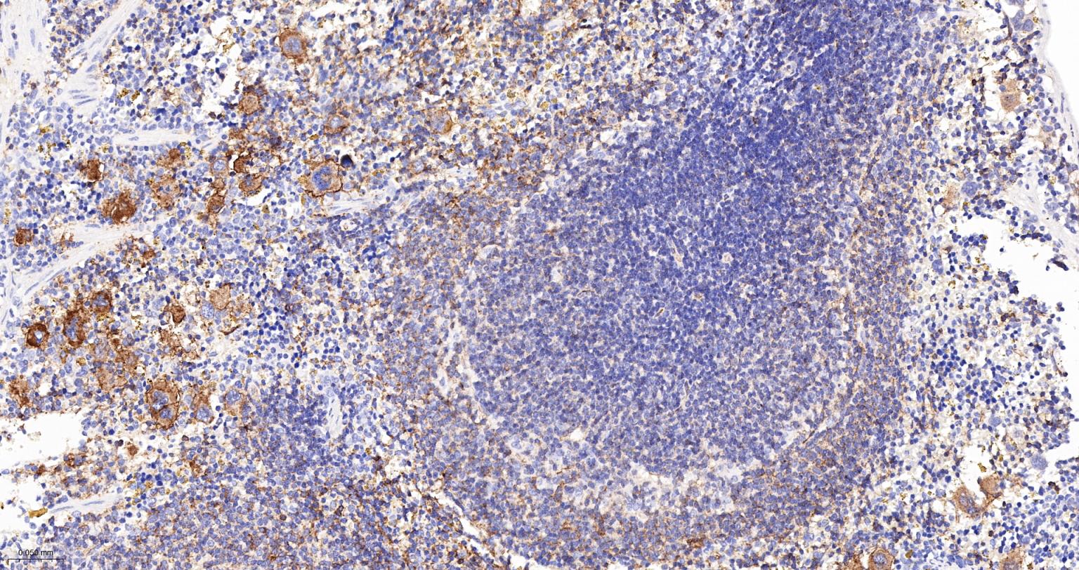 整合素α2（CD49b）重组兔单抗