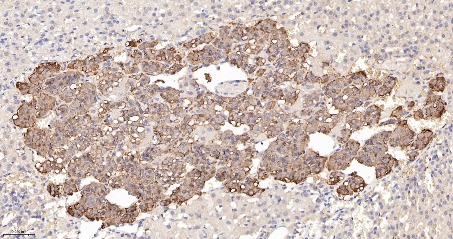 一种肿瘤抑制基因抗体