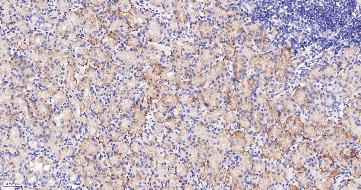 胞质紧密粘连蛋白1/闭锁小带蛋白1重组兔单抗