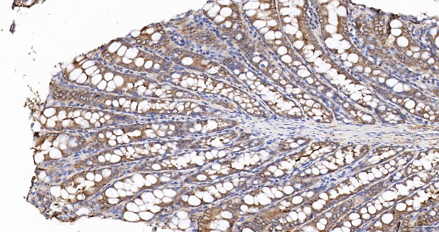 细胞角蛋白18抗体(C端)-bs-1339R