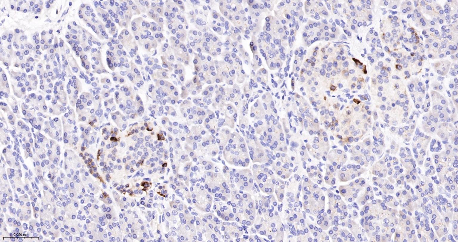 环氧合酶2重组兔单抗