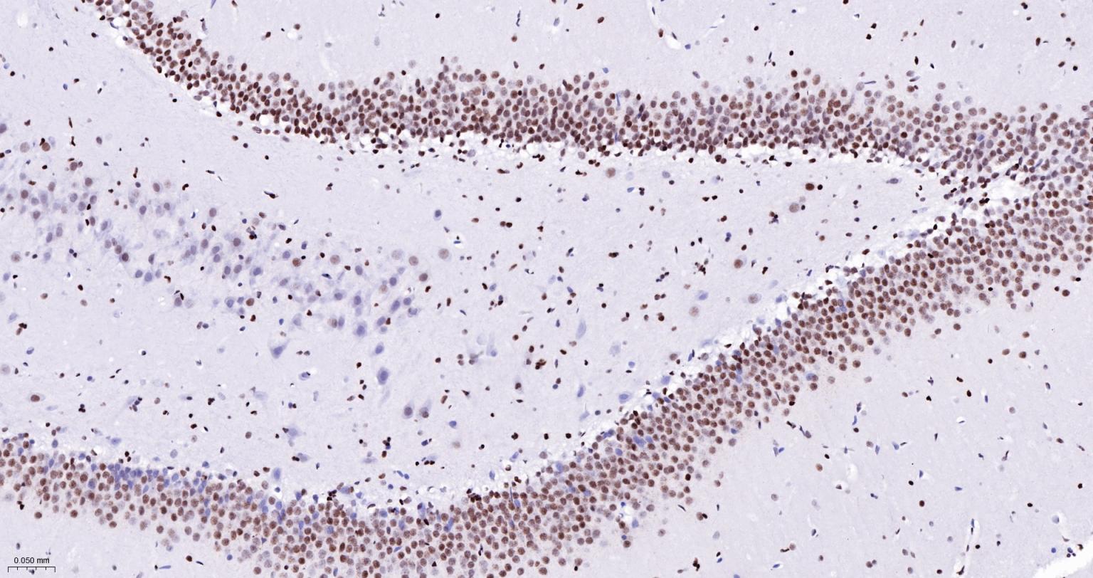 染色体结构维持蛋白质1α重组兔单抗