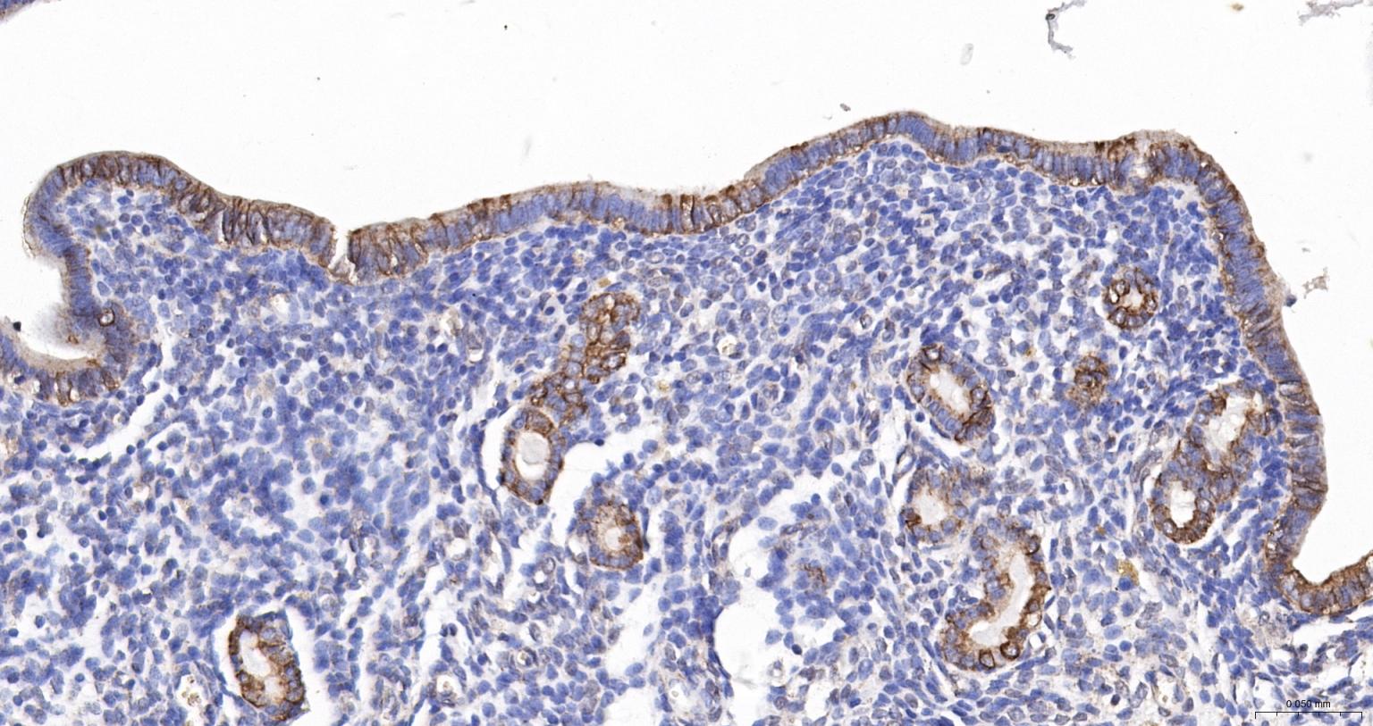 细胞角蛋白18抗体(C端)-bs-1339R